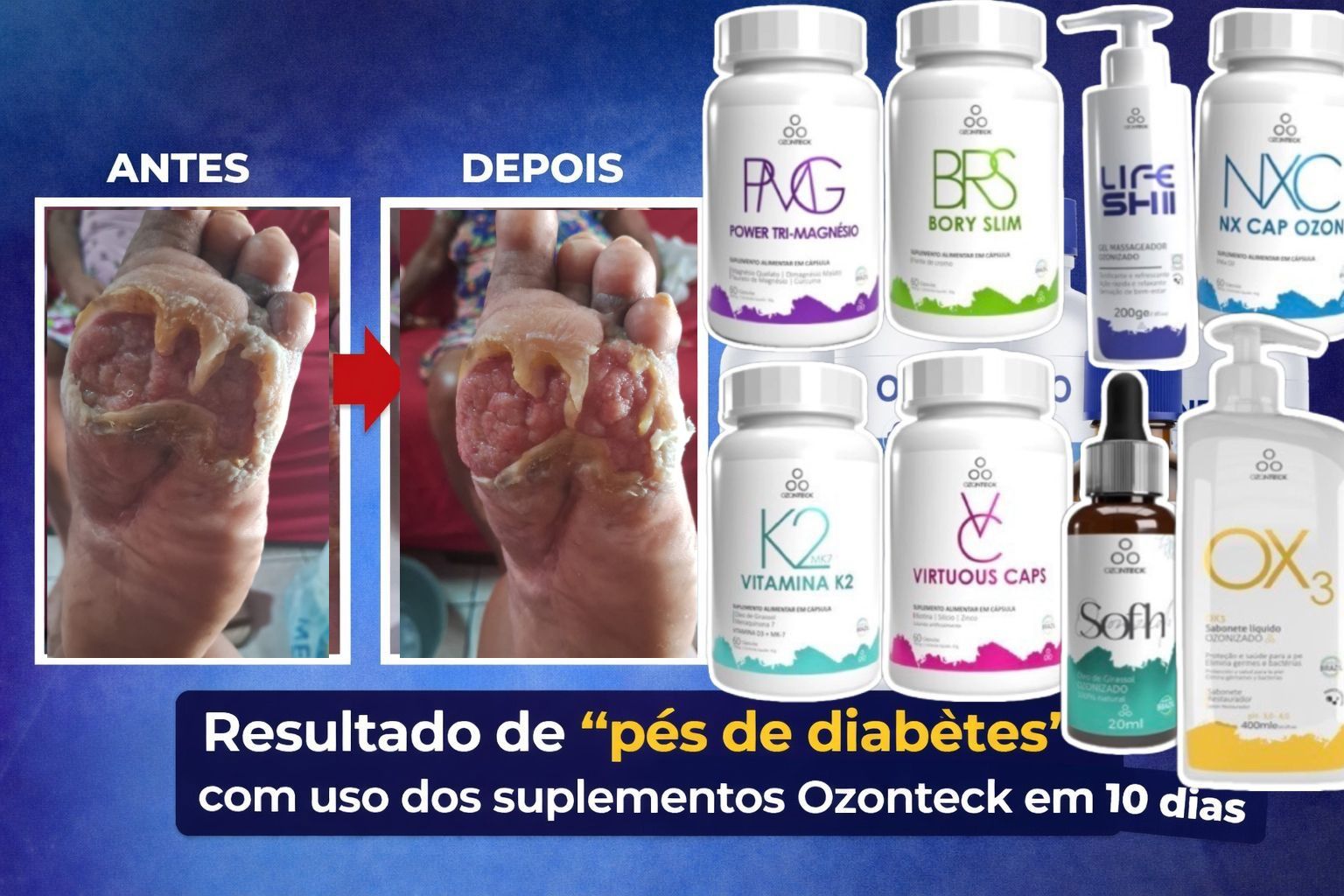 Antes e depois cliente 2